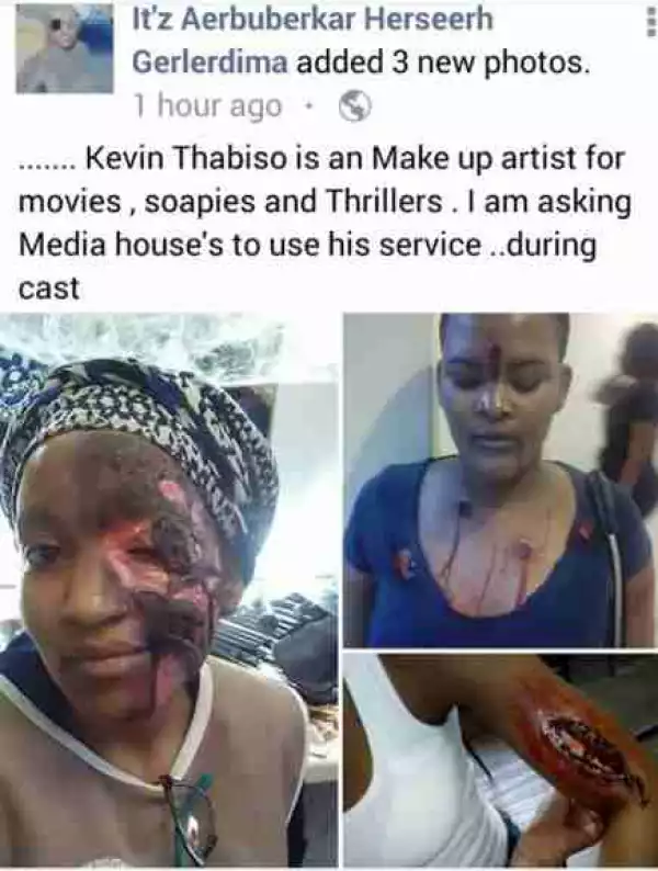 Photos: Makeup Artist Turns Out With Severe Injuries After Artistry Work